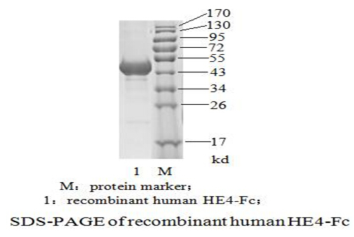 人附睾蛋白4 （HE4）(图2)