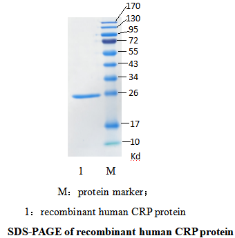 重组人C反应蛋白(图1)