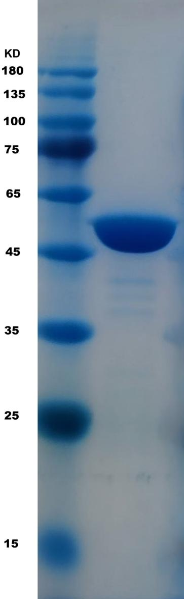 甘油激酶 （ Glycerol Kinase ，GK ）(图1)
